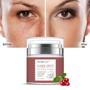 Dark Spot Corrector Removing Fade Cream
